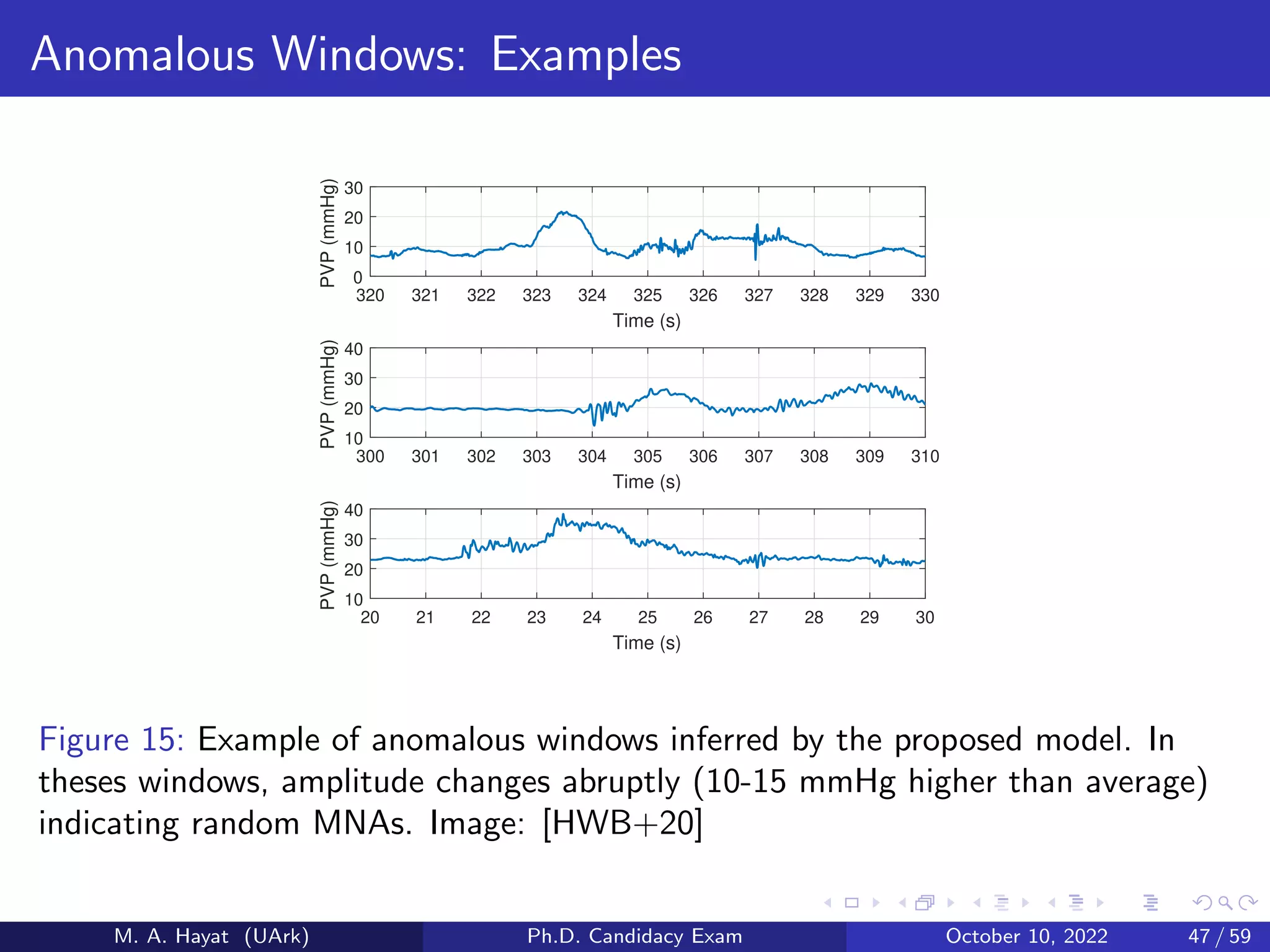 Anomalous Windows: Examples
320 321 322 323 324 325 326 327 328 329 330
Time (s)
0
10
20
30
PVP
(mmHg)
300 301 302 303 304 305 306 307 308 309 310
Time (s)
10
20
30
40
PVP
(mmHg)
20 21 22 23 24 25 26 27 28 29 30
Time (s)
10
20
30
40
PVP
(mmHg)
Figure 15: Example of anomalous windows inferred by the proposed model. In
theses windows, amplitude changes abruptly (10-15 mmHg higher than average)
indicating random MNAs. Image: [HWB+20]
M. A. Hayat (UArk) Ph.D. Candidacy Exam October 10, 2022 47 / 59
 