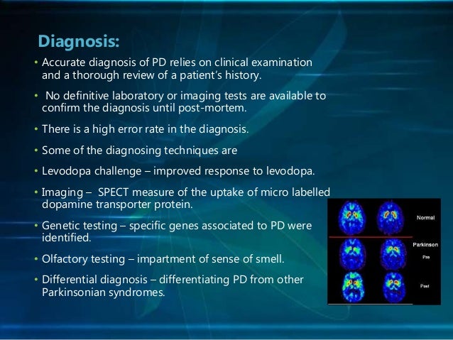 Master thesis picture