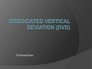 PDF) Dissociated vertical deviation and head tilts