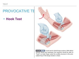 TEXT
PROVOCATIVE TESTS
▸Hook Test
 