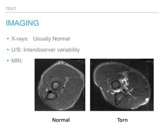 TEXT
IMAGING
▸X-rays: Usually Normal
▸U/S: Interobserver variability
▸MRI:
 