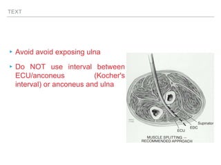TEXT
▸Avoid avoid exposing ulna
▸Do NOT use interval between
ECU/anconeus (Kocher's
interval) or anconeus and ulna
 