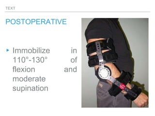 TEXT
POSTOPERATIVE
▸Immobilize in
110°-130° of
flexion and
moderate
supination
 