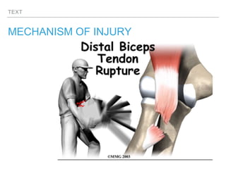TEXT
MECHANISM OF INJURY
 