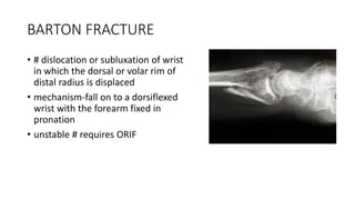 DISTAL END OF RADIUS FRACTURE AND DISLOCATION MANAGEMENT.pptx