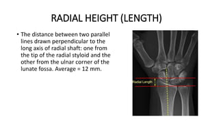RADIAL HEIGHT (LENGTH)
• The distance between two parallel
lines drawn perpendicular to the
long axis of radial shaft: one from
the tip of the radial styloid and the
other from the ulnar corner of the
lunate fossa. Average = 12 mm.
 