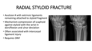 RADIAL STYLOID FRACTURE
• Avulsion # with extrinsic ligaments
remaining attached to styloid fragment
• Mechanism-compression of scaphoid
against styloid with the wrist in
dorsiflexion and ulnar deviation
• Often associated with intercarpal
ligament injury
• Requires ORIF
 