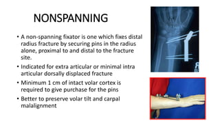 NONSPANNING
• A non-spanning fixator is one which fixes distal
radius fracture by securing pins in the radius
alone, proximal to and distal to the fracture
site.
• Indicated for extra articular or minimal intra
articular dorsally displaced fracture
• Minimum 1 cm of intact volar cortex is
required to give purchase for the pins
• Better to preserve volar tilt and carpal
malalignment
 