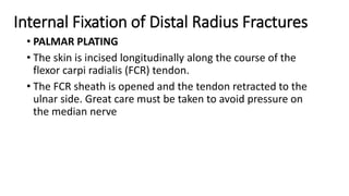 Internal Fixation of Distal Radius Fractures
• PALMAR PLATING
• The skin is incised longitudinally along the course of the
flexor carpi radialis (FCR) tendon.
• The FCR sheath is opened and the tendon retracted to the
ulnar side. Great care must be taken to avoid pressure on
the median nerve
 