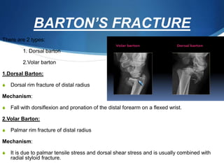 Distal end of radius fractures dr.harish | PPTX