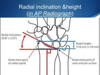 Distal end of radius fractures dr.harish | PPTX
