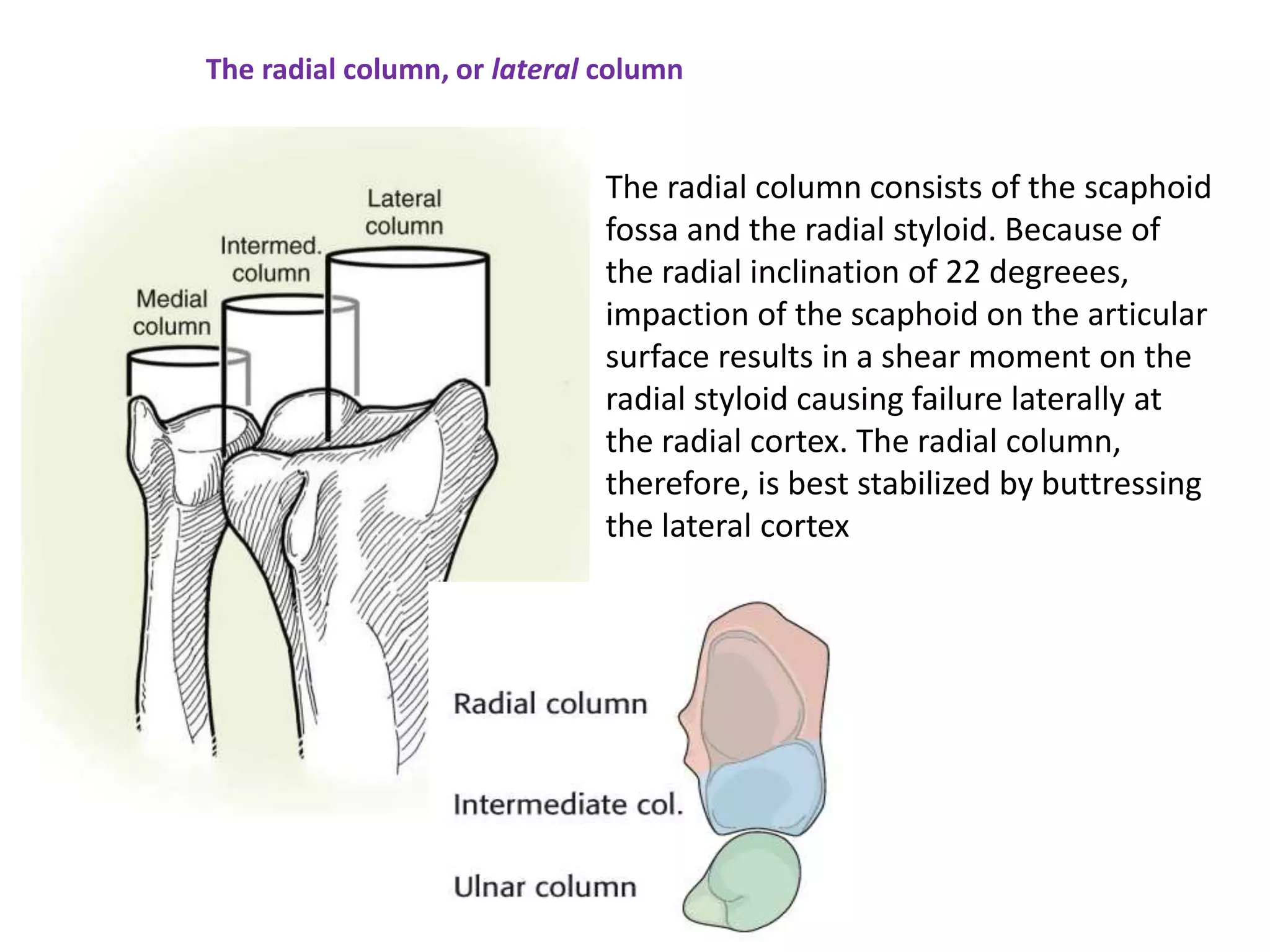 The radial column, or lateral column
The radial column consists of the scaphoid
fossa and the radial styloid. Because of
the radial inclination of 22 degreees,
impaction of the scaphoid on the articular
surface results in a shear moment on the
radial styloid causing failure laterally at
the radial cortex. The radial column,
therefore, is best stabilized by buttressing
the lateral cortex
 