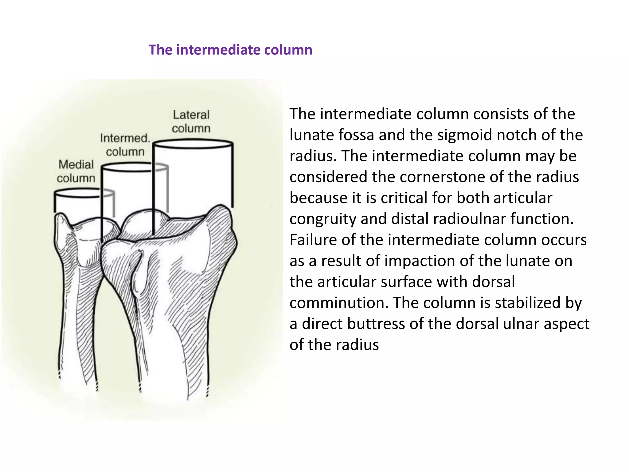 The intermediate column
The intermediate column consists of the
lunate fossa and the sigmoid notch of the
radius. The intermediate column may be
considered the cornerstone of the radius
because it is critical for both articular
congruity and distal radioulnar function.
Failure of the intermediate column occurs
as a result of impaction of the lunate on
the articular surface with dorsal
comminution. The column is stabilized by
a direct buttress of the dorsal ulnar aspect
of the radius
 
