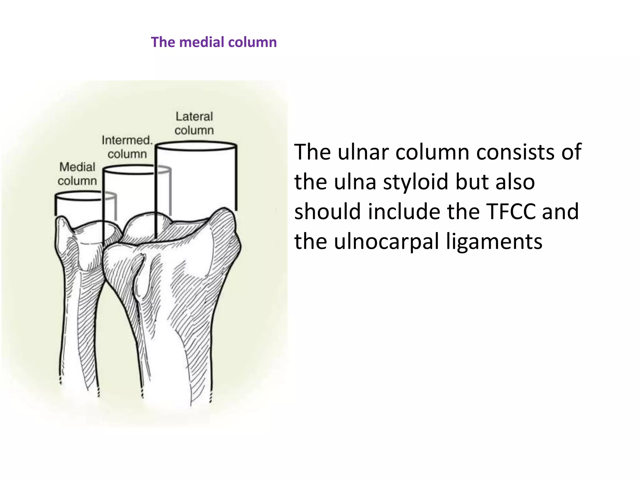 The medial column
The ulnar column consists of
the ulna styloid but also
should include the TFCC and
the ulnocarpal ligaments
 