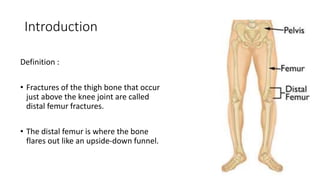 Introduction
Definition :
• Fractures of the thigh bone that occur
just above the knee joint are called
distal femur fractures.
• The distal femur is where the bone
flares out like an upside-down funnel.
 