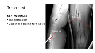 Treatment
Non - Operative :
• Skeletal traction
• Casting and bracing for 6 weeks
 