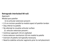 Retrograde interlocked IM nail:
Approach
Medial para patellar
1) no articular extension present :
• 2.5 cm incision parallel to medial aspect of patellar tendon
• Stay inferior to patella
• No attempt to visualize articular surface
2) articular extension present :
• Continue approach 2-8 cm cephalad
• Incise extensor mechanism 10 mm medial to patella
• Eversion of patella not typically necessary
• Need to stabilize articular segments prior to nail placement
 