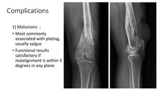 Complications
1) Malunions :
• Most commonly
associated with plating,
usually valgus
• Functional results
satisfactory if
malalignment is within 5
degrees in any plane
 