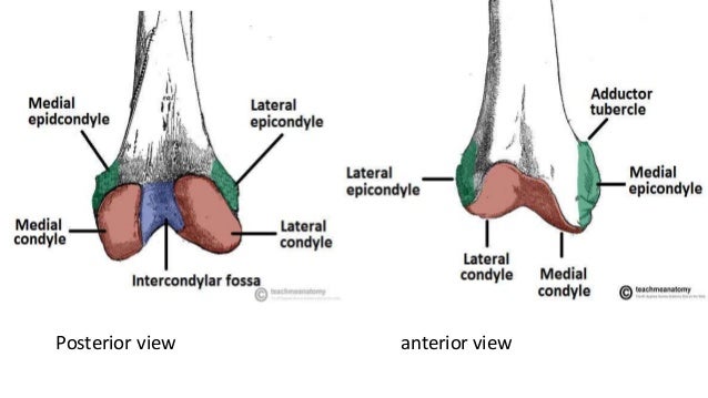 Distal femur fracture split femur diagram 