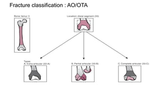 distal femur fractures classification with treatment | PPTX