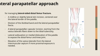 Comprehensive Overview of Distal Femur Fractures: Diagnosis, Anatomy ...