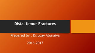 Distal femur Fractures
Prepared by : Dr.Loay Aburaiya
2016-2017
 