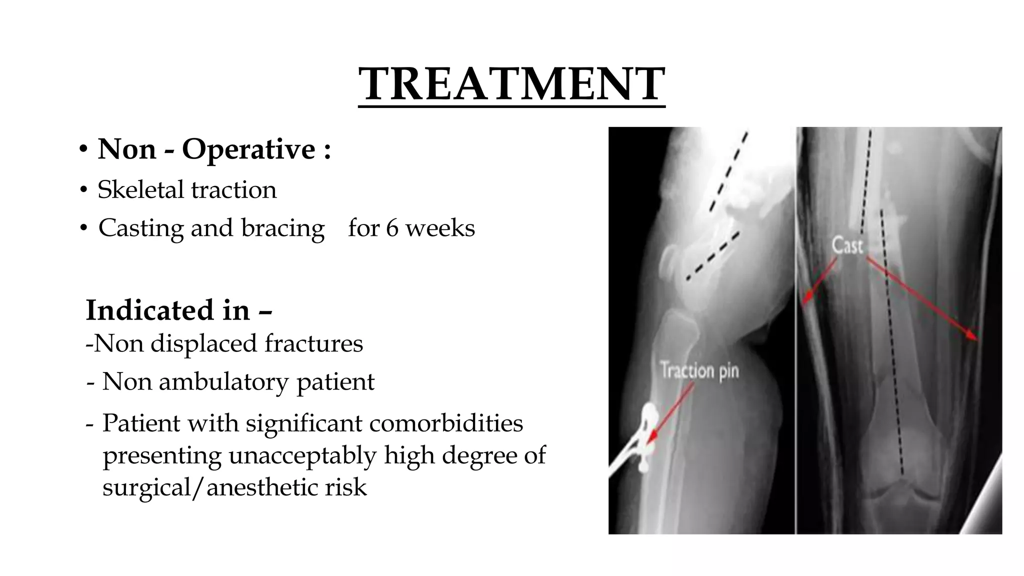 Distal femur fractures dr.shubham.pptx