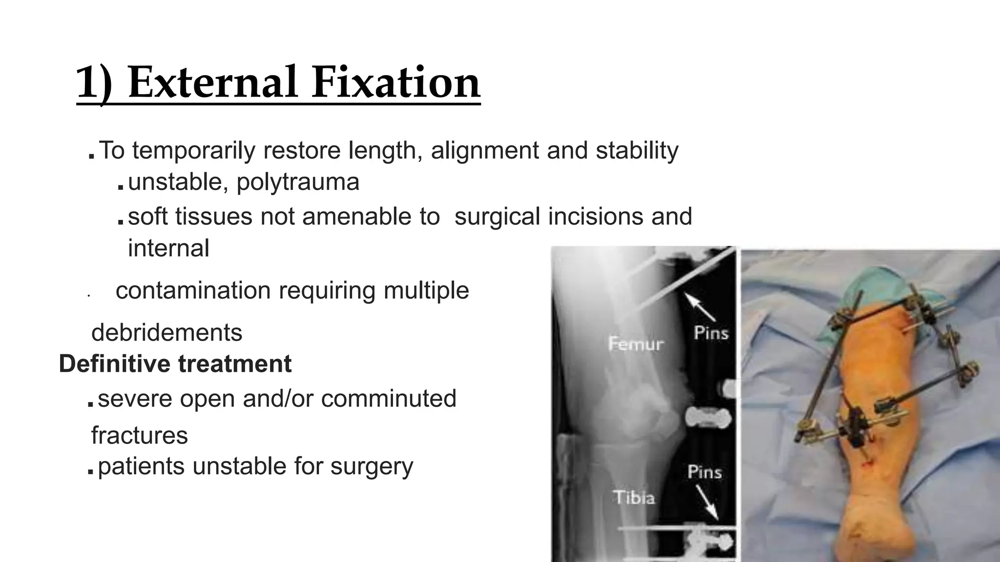 Distal femur fractures dr.shubham.pptx