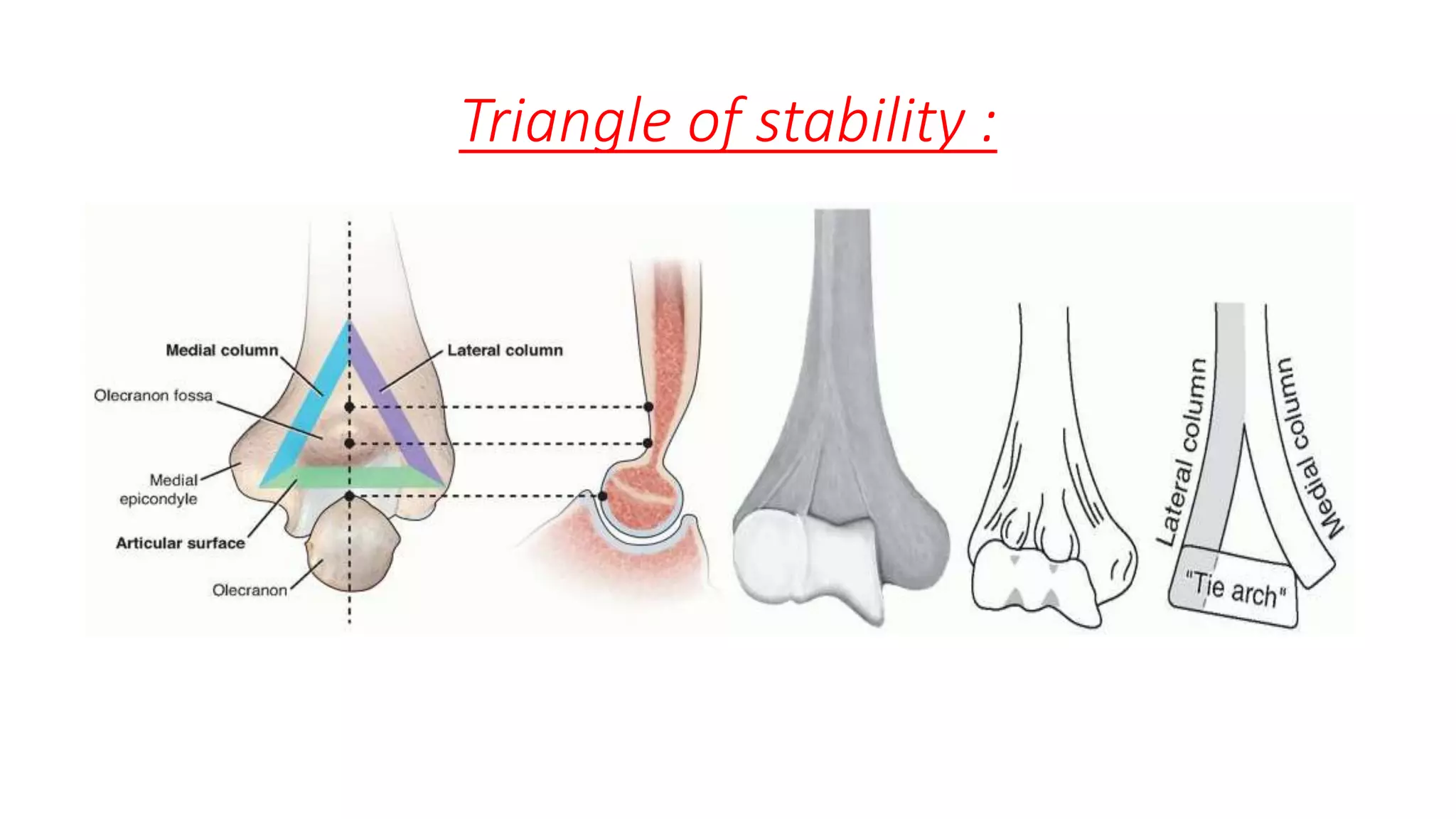 Distal humeral fracture | PPTX