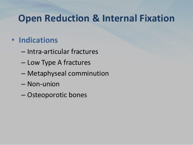 Open Reduction & Internal Fixation
• Indications
– Intra-articular fractures
– Low Type A fractures
– Metaphyseal comminution
– Non-union
– Osteoporotic bones
 