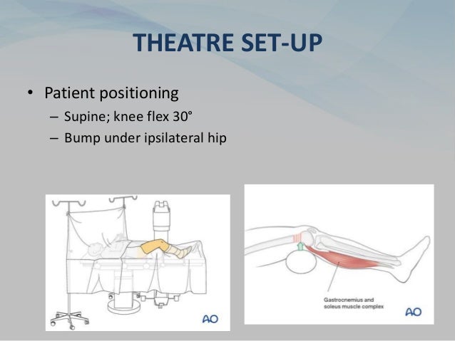 THEATRE SET-UP
• Patient positioning
– Supine; knee flex 30°
– Bump under ipsilateral hip
 