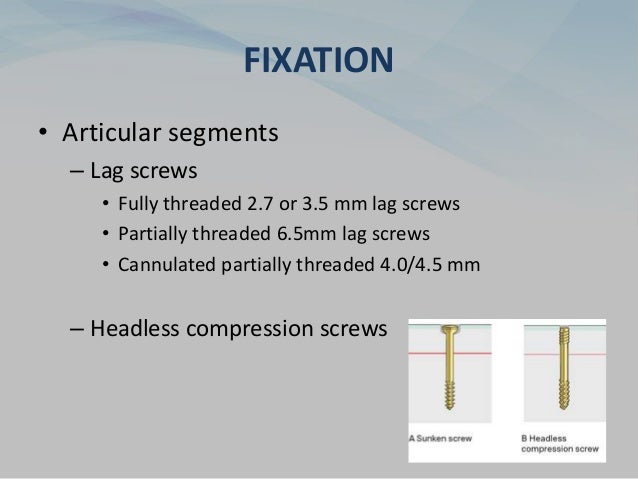 FIXATION
• Articular segments
– Lag screws
• Fully threaded 2.7 or 3.5 mm lag screws
• Partially threaded 6.5mm lag screws
• Cannulated partially threaded 4.0/4.5 mm
– Headless compression screws
 