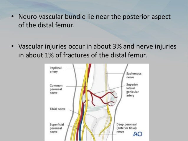 • Neuro-vascular bundle lie near the posterior aspect
of the distal femur.
• Vascular injuries occur in about 3% and nerve injuries
in about 1% of fractures of the distal femur.
 
