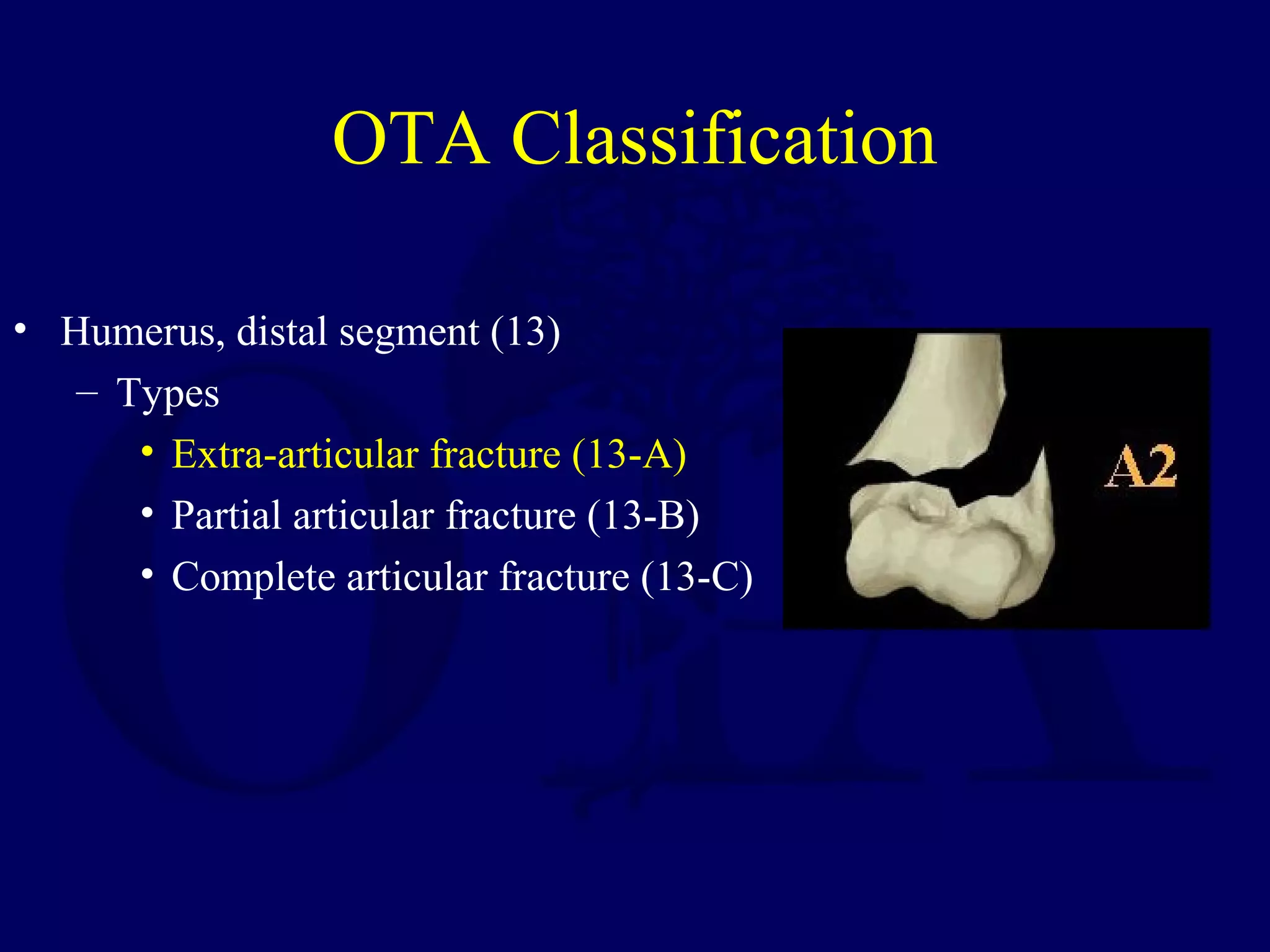 OTA Classification

• Humerus, distal segment (13)
   – Types
      • Extra-articular fracture (13-A)
      • Partial articular fracture (13-B)
      • Complete articular fracture (13-C)
 