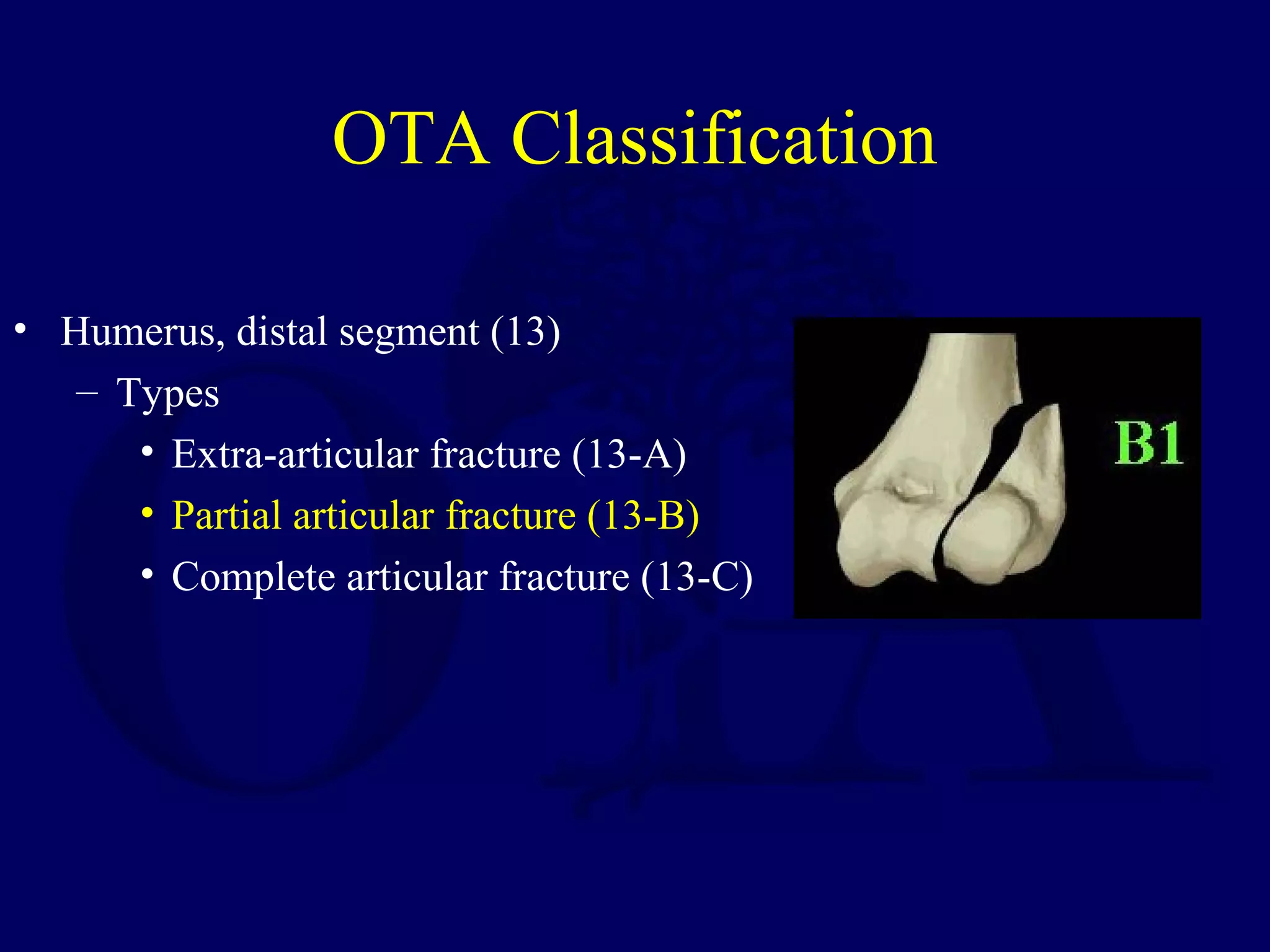 OTA Classification

• Humerus, distal segment (13)
   – Types
      • Extra-articular fracture (13-A)
      • Partial articular fracture (13-B)
      • Complete articular fracture (13-C)
 