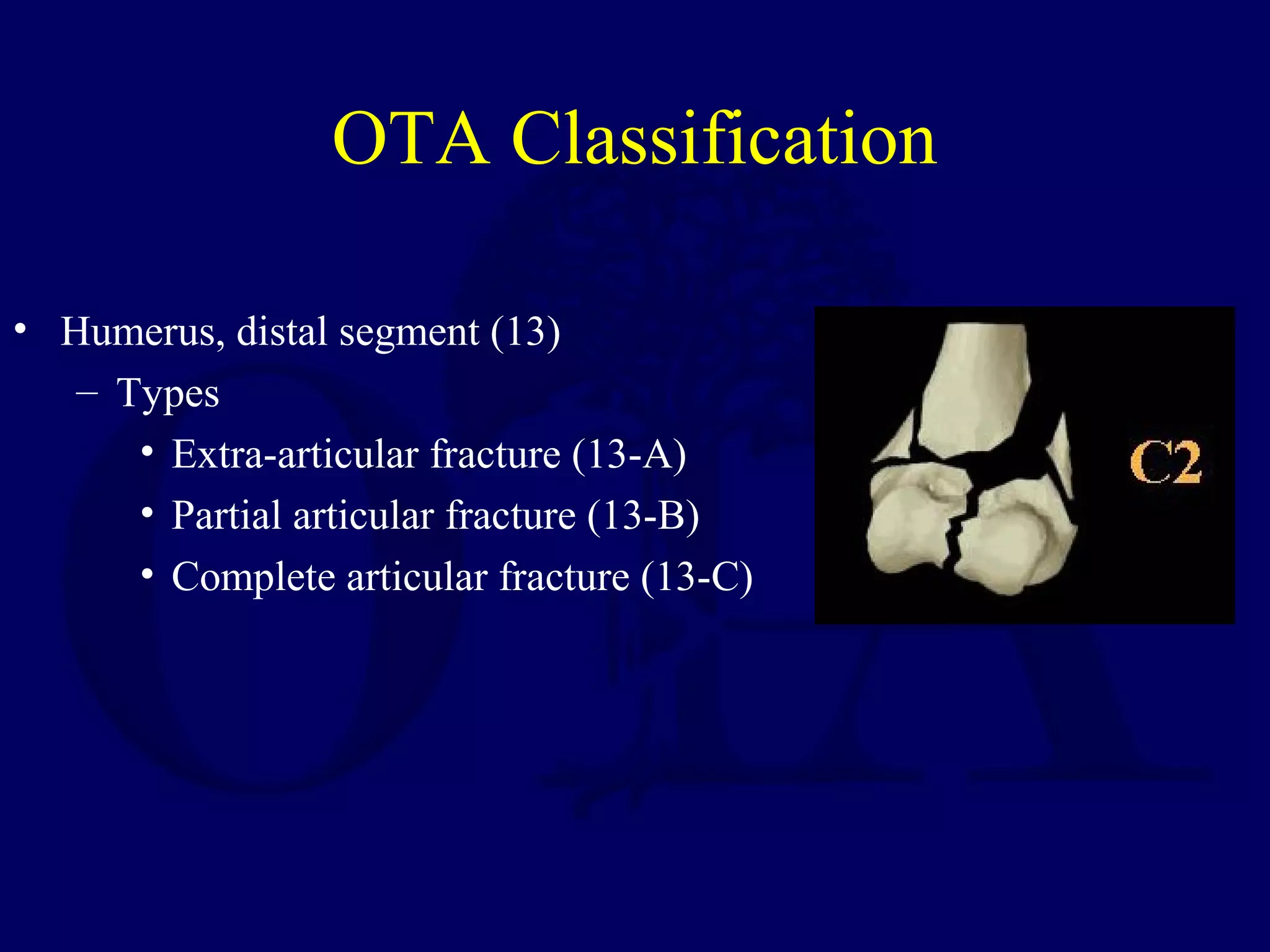 OTA Classification

• Humerus, distal segment (13)
   – Types
      • Extra-articular fracture (13-A)
      • Partial articular fracture (13-B)
      • Complete articular fracture (13-C)
 