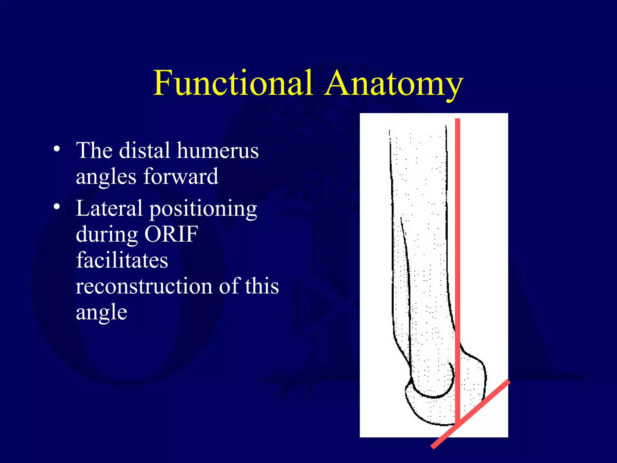 Functional Anatomy
• The distal humerus
  angles forward
• Lateral positioning
  during ORIF
  facilitates
  reconstruction of this
  angle
 