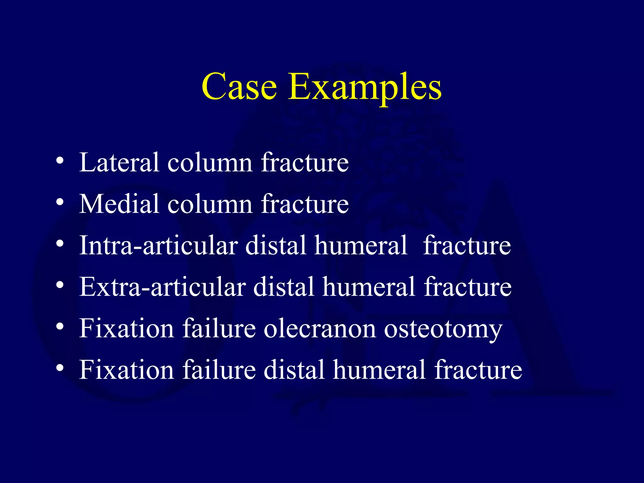 Case Examples
•   Lateral column fracture
•   Medial column fracture
•   Intra-articular distal humeral fracture
•   Extra-articular distal humeral fracture
•   Fixation failure olecranon osteotomy
•   Fixation failure distal humeral fracture
 