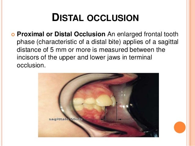 distal occlusion