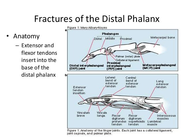 Distal phalanx fracture