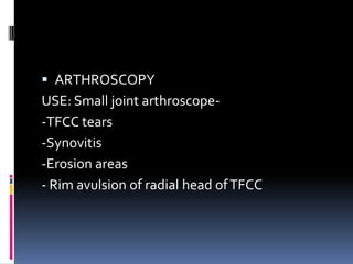  ARTHROSCOPY
USE: Small joint arthroscope-
-TFCC tears
-Synovitis
-Erosion areas
- Rim avulsion of radial head ofTFCC
 