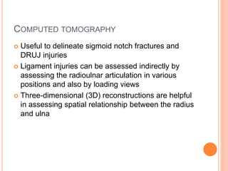 COMPUTED TOMOGRAPHY
 Useful to delineate sigmoid notch fractures and
DRUJ injuries
 Ligament injuries can be assessed indirectly by
assessing the radioulnar articulation in various
positions and also by loading views
 Three-dimensional (3D) reconstructions are helpful
in assessing spatial relationship between the radius
and ulna
 