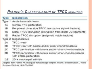 PALMER’S CLASSIFICATION OF TFCC INJURIES
 