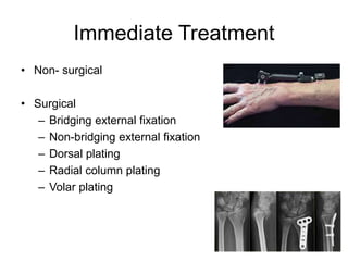 Immediate Treatment
• Non- surgical
• Surgical
– Bridging external fixation
– Non-bridging external fixation
– Dorsal plating
– Radial column plating
– Volar plating
 