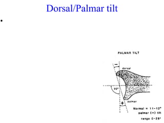 Distal radius fracture | PPT