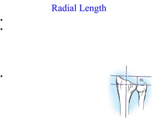 Radial Length 
• Inclination of radius towards the ulna 
• measured by a line drawn perpendicular to the 
long axis of the...