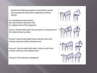 Distal radius fracture | PPTX