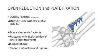 Distal radius fracture in adults | PPTX