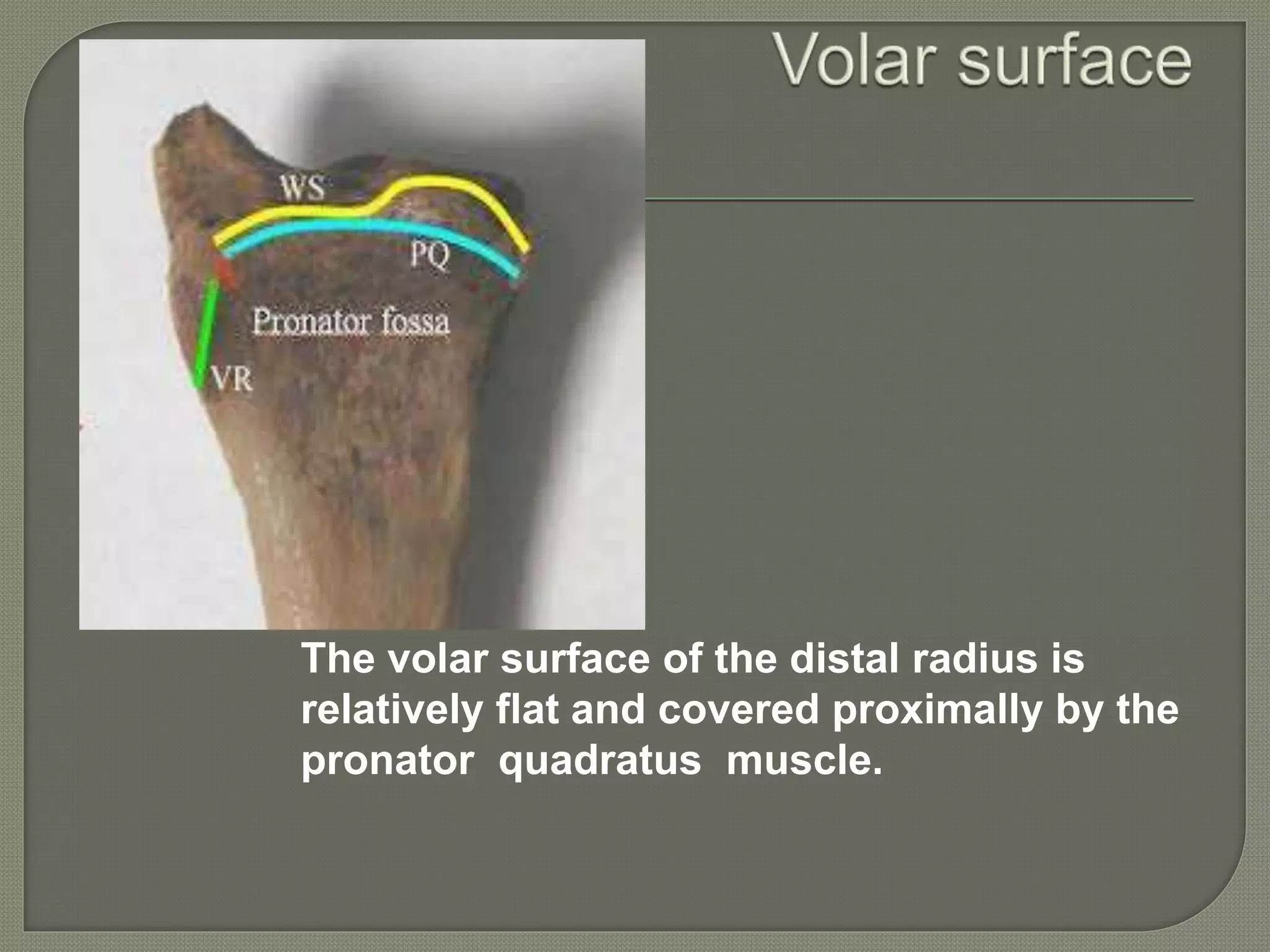 The volar surface of the distal radius is
relatively flat and covered proximally by the
pronator quadratus muscle.
 
