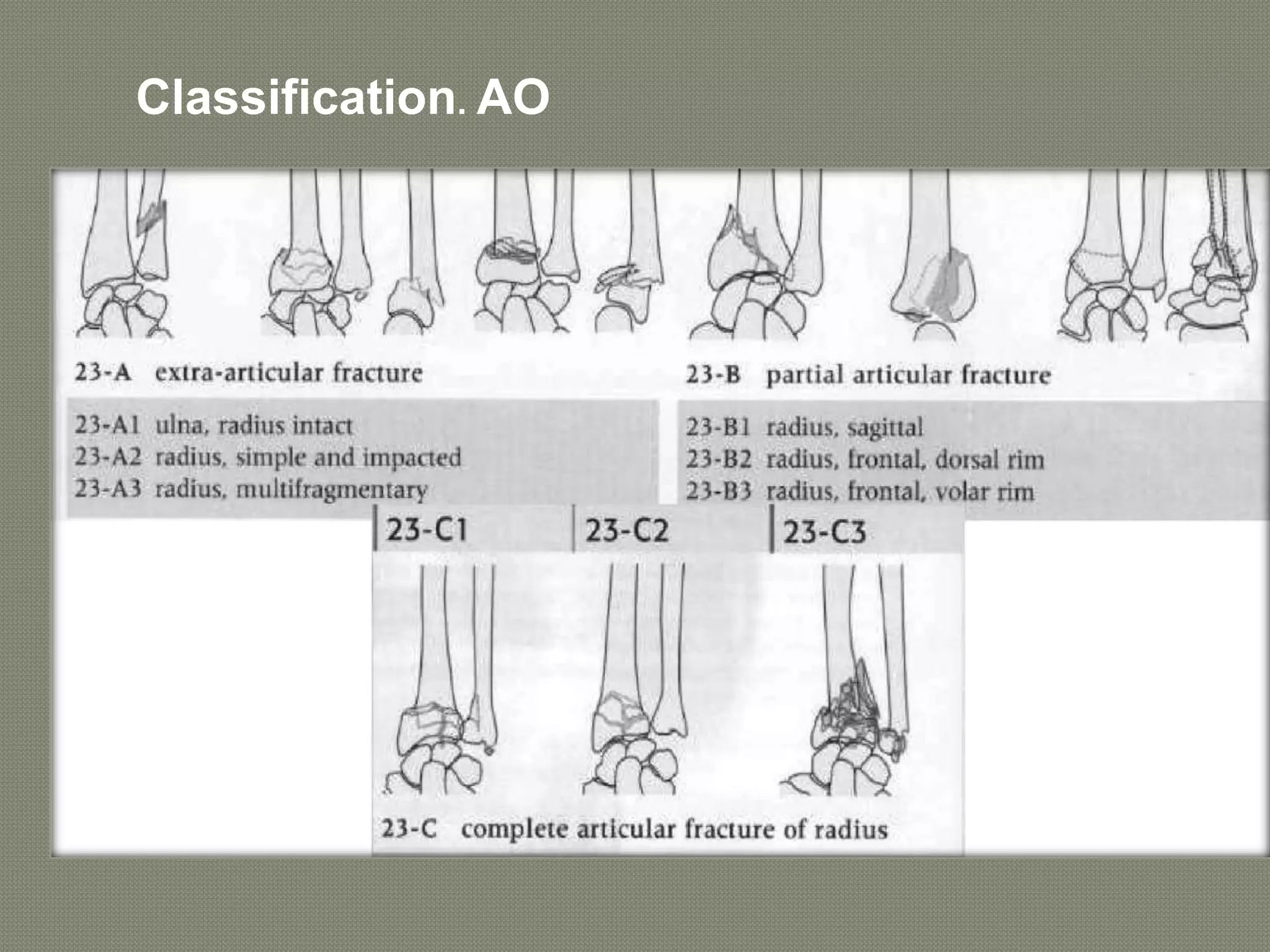 .
Classification. AO
 